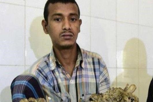 人身上還能夠長出樹枝？這名男子就是如此！