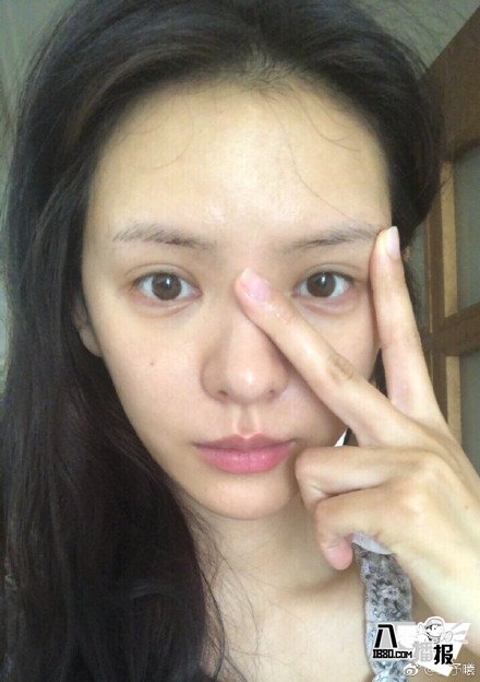 張予曦回應外貌爭議,張予曦黑歷史盤點脖子上吻痕是怎么回事?(圖5) 圖片