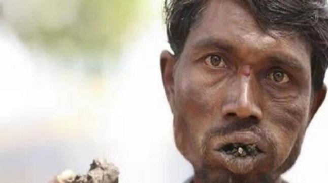 有人喜歡吃土,這都是什么特殊的愛好(圖2) 有人喜歡吃土,這都是什么特殊的愛好(圖2)